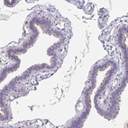Immunohistochemical staining of human fallopian tube shows high expression.