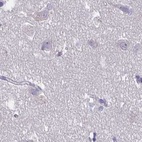 Immunohistochemical staining of human cerebral cortex using Anti-CFAP74 antibody HPA028521.