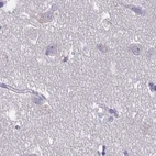 Immunohistochemical staining of human cerebral cortex using Anti-CFAP74 antibody HPA028521.