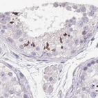 Immunohistochemical staining of human testis using Anti-CFAP74 antibody HPA028521.