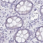 Immunohistochemical staining of human colon using Anti-CFAP74 antibody HPA028521.