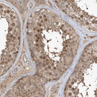 Anti-WDR26 Antibody