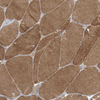 Immunohistochemical staining of human skeletal muscle shows strong cytoplasmic positivity in myocytes.