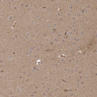 Immunohistochemical staining of human cerebral cortex shows moderate positivity in neuropil.