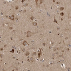 Anti-LUZP1 Antibody