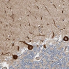 Immunohistochemical staining of human cerebellum shows strong cytoplasmic positivity in Purkinje cells.