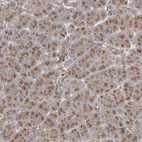 Immunohistochemical staining of human pancreas shows moderate cytoplasm granular 
positivity in exocrine glandular cells.