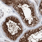 Anti-HSPA6 Antibody