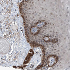 Anti-HSPA6 Antibody