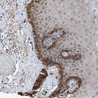 Immunohistochemical staining of human Skin shows moderate nuclear and cytoplasmic positivity in squamous epithelial cells.