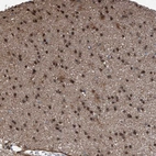 Immunohistochemical staining of human Cerebral cortex shows moderate nuclear positivity in glial cells.