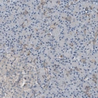Immunohistochemical staining of human Pancreas shows no positivity in exocrine glandular cells as expected.