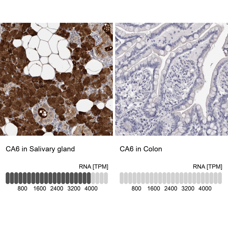 Anti-CA6 Antibody