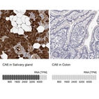 Anti-CA6 Antibody