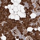 Immunohistochemical staining of human salivary gland shows high expression.