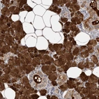 Immunohistochemical staining of human salivary gland shows high expression.
