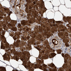 Immunohistochemical staining of human salivary gland shows strong cytoplasmic positivity in glandular cells.