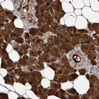 Immunohistochemical staining of human salivary gland shows strong cytoplasmic positivity in glandular cells.