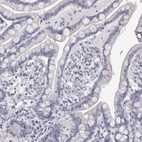 Immunohistochemical staining of human colon shows low expression as expected.