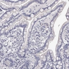Immunohistochemical staining of human colon shows low expression as expected.