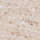 Anti-UBXN10 Antibody