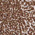 Anti-ACP6 Antibody