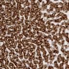 Anti-ACP6 Antibody