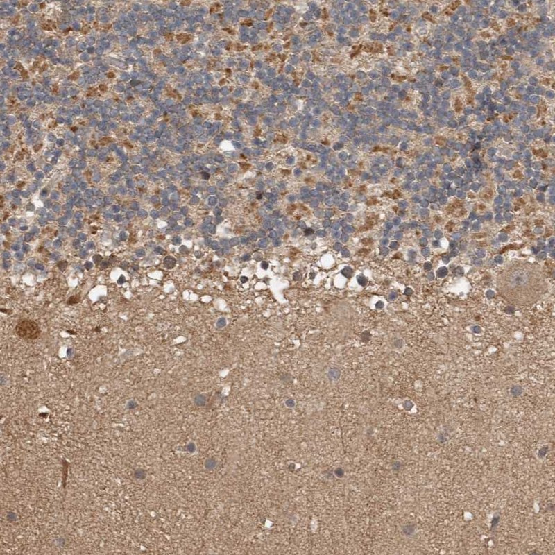 Anti-KIF26B Antibody