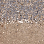 Anti-KIF26B Antibody