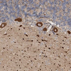 Anti-KIF26B Antibody