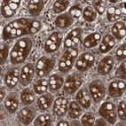 Anti-FLAD1 Antibody