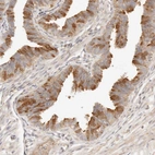 Anti-UBXN10 Antibody