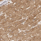 Immunohistochemical staining of human heart muscle shows moderate cytoplasmic positivity in cardiomyocytes.