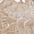 Immunohistochemical staining of human skeletal muscle shows weak cytoplasmic positivity in myocytes.