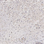 Immunohistochemical staining of human prostate shows no positivity in smooth muscle cells as expected.