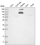 Western blot analysis in human cell line RT-4, human cell line U-251 MG, human plasma, human liver tissue and human tonsil tissue.
