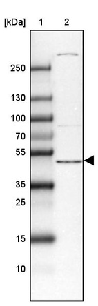 Lane 1: Marker [kDa] 250, 130, 100, 70, 55, 35, 25, 15, 10_br/_Lane 2: Human Liver tissue