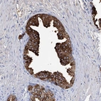 Anti-GPR52 Antibody
