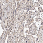 Anti-ADAMTS9 Antibody