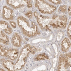 Immunohistochemical staining of human kidney shows moderate cytoplasmic positivity in cells in tubules.
