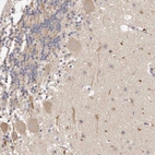 Immunohistochemical staining of human cerebellum shows weak cytoplasmic positivity in Purkinje cells.