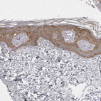 Anti-NUDT18 Antibody