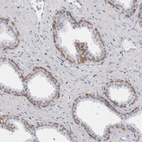 Anti-NUDT18 Antibody