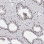 Immunohistochemical staining of human prostate shows strong cytoplasmic positivity in basal cells.
