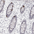 Immunohistochemical staining of human colon shows strong cytoplasmic positivity in glandular cells.