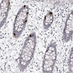Immunohistochemical staining of human colon shows strong cytoplasmic positivity in glandular cells.