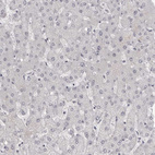 Anti-NUDT18 Antibody