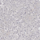 Immunohistochemical staining of human liver shows no positivity in hepatocytes as expected.