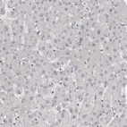 Immunohistochemical staining of human liver shows no positivity in hepatocytes as expected.