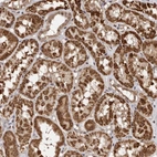 Anti-CCDC190 Antibody